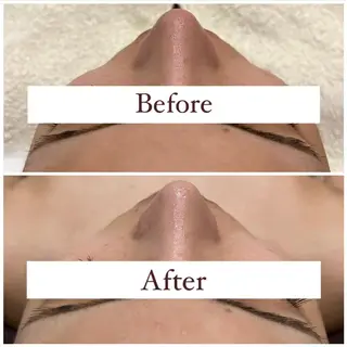 ハーブピーリング専門 muro.のエステ・リラクイメージ