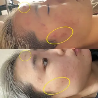 Harry•ハリー🩵韓国コルギとヘアラインのお店所属・韓国肌管理HARRY ・ハリー🤍大村のエステ・リラクイメージ