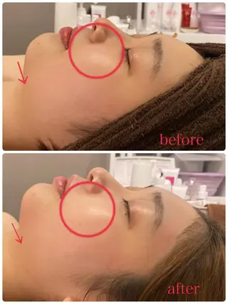 肌改善/まつげパーマ 🌙Luunaのエステ・リラクイメージ