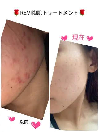 y.laBelle所属・y.laBelle 艶肌・小顔・肌質改善のエステ・リラクイメージ