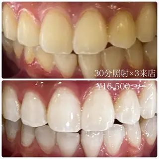 メンズ ホワイトニングルーム　川崎店所属・ホワイトニング ルーム　川崎店のその他イメージ