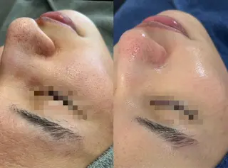 PERSONAL BEAUTY🪻のエステ・リラクイメージ