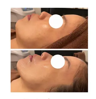 Meow！～トラブル肌専門ピーリング＆脱毛サロン～所属・トラブル肌改善🏥 Meow！🫧🫧のその他イメージ