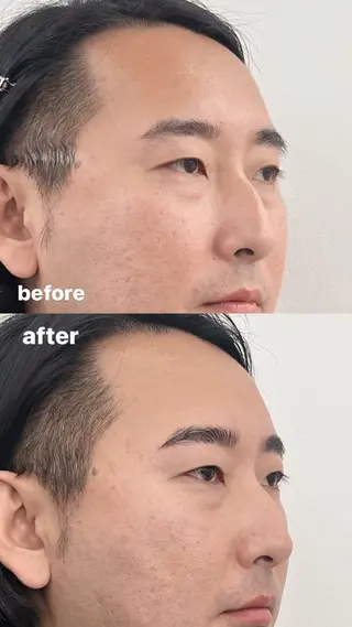 メンズ アイブロウ カルフールリル　草加所属・草加/ miyu 🫧の眉毛・アイブロウイメージ