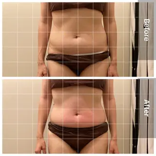 美容鍼/ヘッドスパ/ 💎さかもとのエステ・リラクイメージ