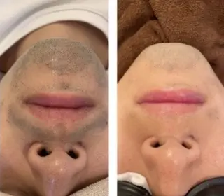 メンズ まつげパーマ×眉毛×脱毛　Cerise Lala所属・CeriesLaLa 大船店のマツエク・マツパデザイン