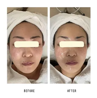 grow所属・Yoshino Erinaのエステ・リラクイメージ