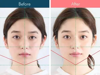 美容鍼専門サロン Hari Lounge 恵比寿本店所属・菅野 舞のエステ・リラクイメージ