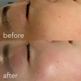 エステティックサロン Liente(リアンテ)所属・Hashimoto .のエステ・リラクイメージ