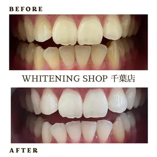 メンズ ホワイトニング ショップ千葉店のその他イメージ
