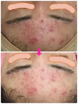 ロング カラー パーマ ヘアアレンジ メンズ キッズ ネイル マツエク・マツパ ‍痩身＆ボディ 結果出し🌟丹野のエステ・リラクイメージ