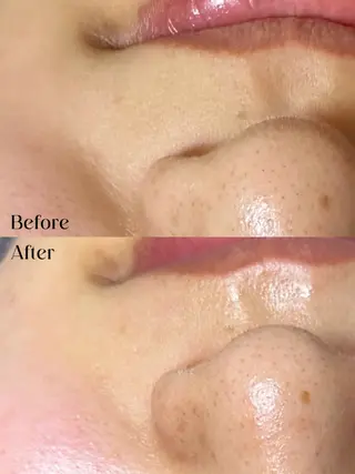 Hit. シュガーリング豊橋のエステ・リラクイメージ