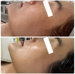 Esthe salon Blanche(エステサロンブランシュ)所属・小顔リフトアップ 美肌改善専門店のエステ・リラクイメージ