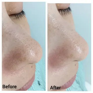 シミケア専門店 HAQUAのその他イメージ