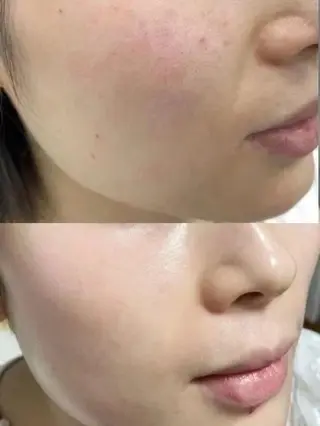 マツエク・マツパ aliaハイフ&水光ジェットサロン所属・aliaハーブ水光店 エステティシャン募集のエステ・リラクイメージ