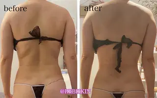 【痩身・脱毛サロン】 REBISKIN🌱のエステ・リラクイメージ