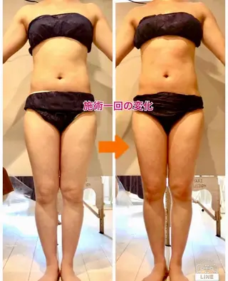 ショート カラー パーマ ヘアアレンジ メンズ キッズ ネイル マツエク・マツパ ‍痩身＆ボディ 結果出し🌟丹野のエステ・リラクイメージ