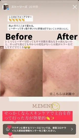 脱毛 &relaxation　M.EMINY所属・大分賀来リラクサロン M.EMINYのエステ・リラクイメージ