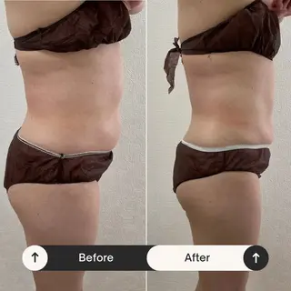 メンズ キッズ ホワイトニングサロン プレジールのエステ・リラクイメージ