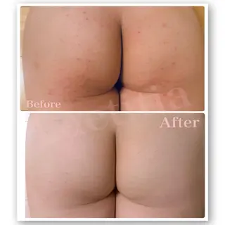 レティティア【Laetitia】所属・レティティア秋葉原店 Yoshizawaのエステ・リラクイメージ