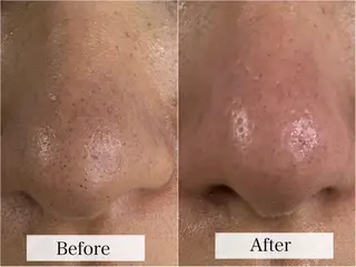 Linoas所属・kogao&head Linoasのその他イメージ