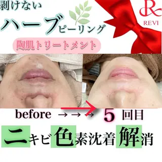 laluna saki...のその他イメージ