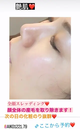 アイブロウ ハーブピーリング/韓国肌管理/フェイシャル/毛穴洗浄/眉毛/顔脱毛【糸脱毛専門】rev所属・ハーブピーリング🌹 毛穴洗浄❤️眉waxのエステ・リラクイメージ