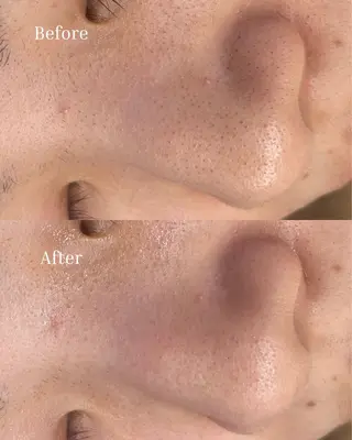 BELLIS HUIT所属・ハーブピーリング那覇 BELLISHUITのエステ・リラクイメージ