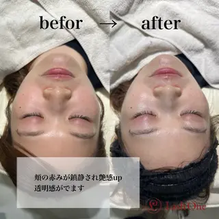 Lashone所属・Lash  One 四条店のエステ・リラクイメージ