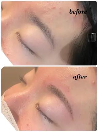 アイブロウ ハーブピーリング/韓国肌管理/フェイシャル/毛穴洗浄/眉毛/顔脱毛【糸脱毛専門】rev所属・ハーブピーリング🌹 毛穴洗浄❤️眉waxのエステ・リラクイメージ