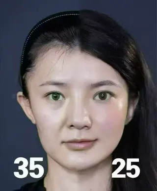 ネイル aliaハイフ&水光ジェットサロン所属・aliaハーブ水光店 エステティシャン募集のエステ・リラクイメージ