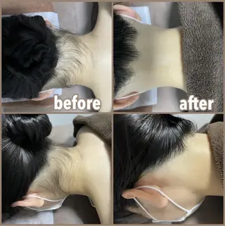 RinRin 長野店のエステ・リラクイメージ