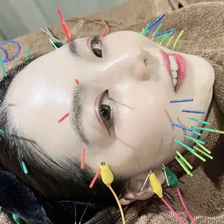 Spring鍼灸院所属・Spring鍼灸院 ✨首肩こり、腰痛に！のエステ・リラクイメージ