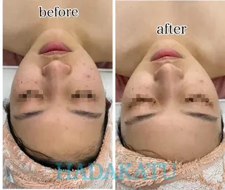 総合エステサロン 肌活のエステ・リラクイメージ