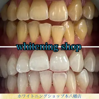 メンズ ホワイトニング ショップ本八幡店のエステ・リラクイメージ