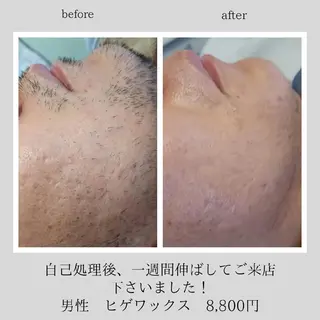 メンズ Lutella所属・ワックス脱毛専門店 Lutellaのエステ・リラクイメージ