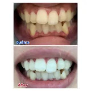 M渋谷店所属・M渋谷 ホワイトニングのエステ・リラクイメージ