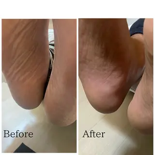 ネイル 大人キレイ 𝑁𝑖𝑥𝑖𝑠のネイルデザイン