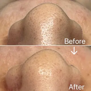 Blue Moon 【ブルームーン】のエステ・リラクイメージ