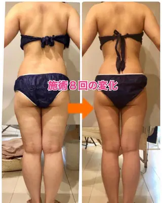 ショート カラー パーマ ヘアアレンジ メンズ キッズ ネイル マツエク・マツパ ‍痩身＆ボディ 結果出し🌟丹野のエステ・リラクイメージ