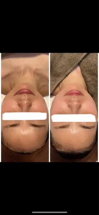 メナードフェイシャルサロン LORO所属・メナードフェイシャル サロンLOROのエステ・リラクイメージ