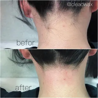 CLEAD 赤坂見附店のエステ・リラクイメージ