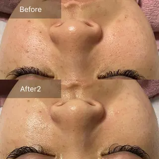 ALIA Scintiller  アリアサンティエ所属・齋藤 祐里耶のエステ・リラクイメージ