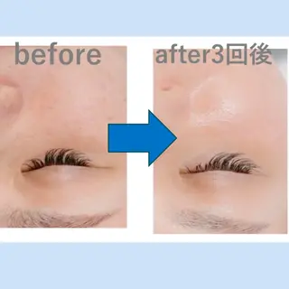 Mia.rosa所属・光フェイシャル・脱毛 MIA.ROSAの眉毛・アイブロウイメージ