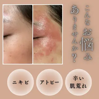 お肌と歯のサロン　Sona Mior所属・藤井 ののみのエステ・リラクイメージ