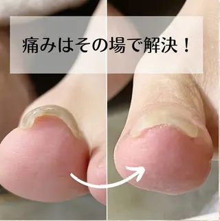 ネイル 深爪・巻き爪 専門サンセリテのネイルデザイン