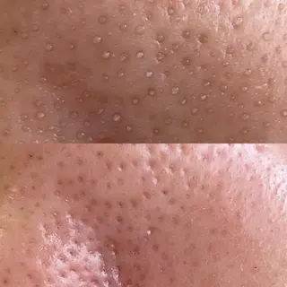 はり灸サロン totonoi所属・印象の良くなる 美容鍼のエステ・リラクイメージ