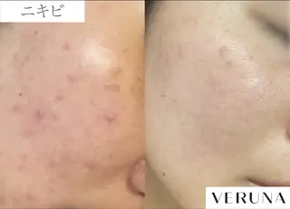 業界初の頭皮ケア 棘スカルプLUNEAのヘアスタイル