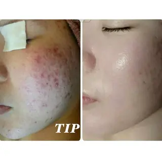 フェイシャル専門 肌質改善/プランスのエステ・リラクイメージ