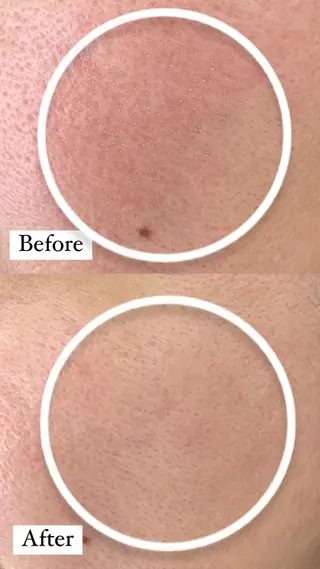 デ・アイム新潟　　北所属・山口 萌のエステ・リラクイメージ